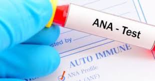 Anti Nuclear antibody (ANA)