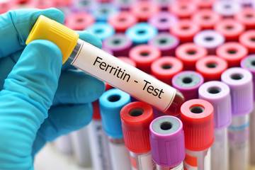 Ferritin