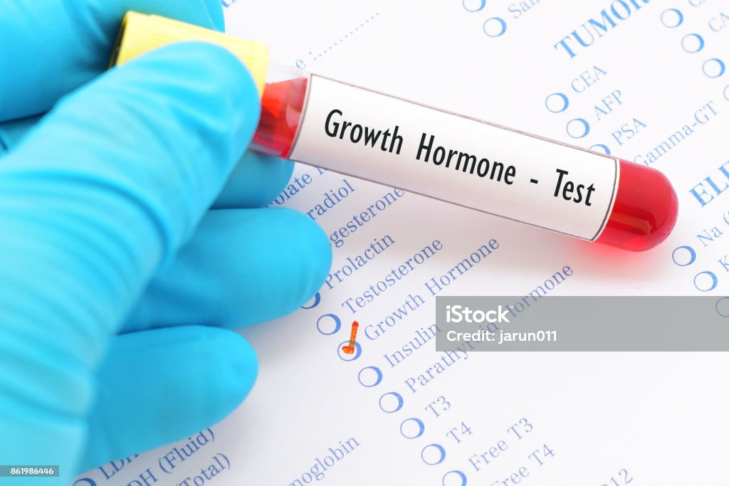 Growth hormone