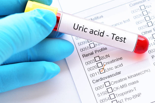 Uric Acid