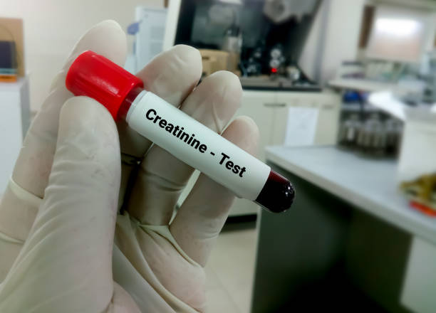 Creatinine