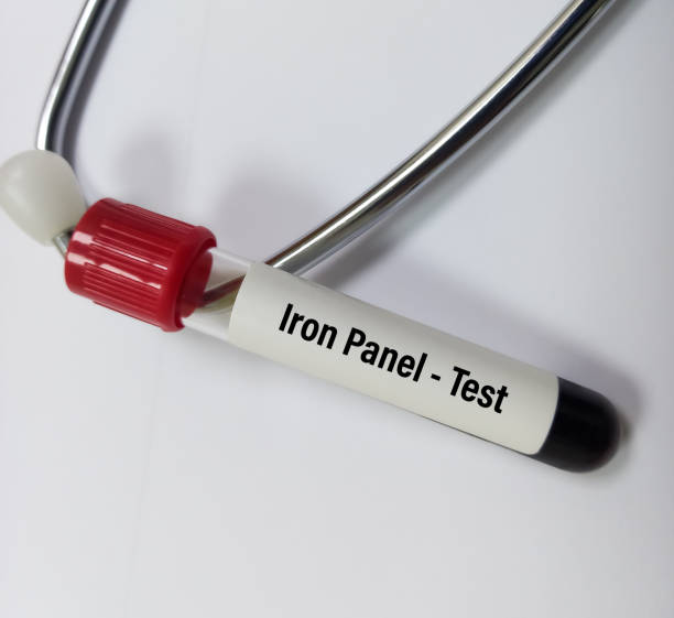 Serum Iron