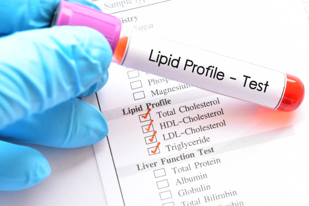 LDL . Cholesterol