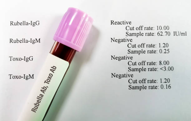 Rubella IgG