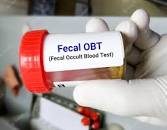 Fecal occult blood test (FOBT)